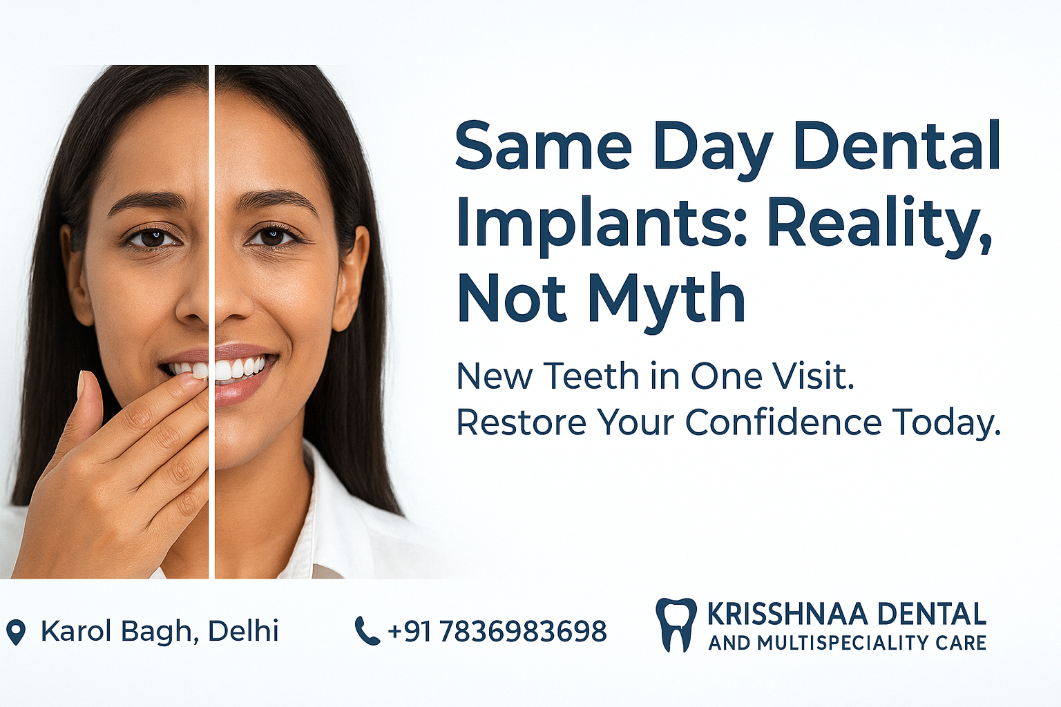 ? Get New Teeth in a Day: Same Day Dental Implants in Karol Bagh, Delhi